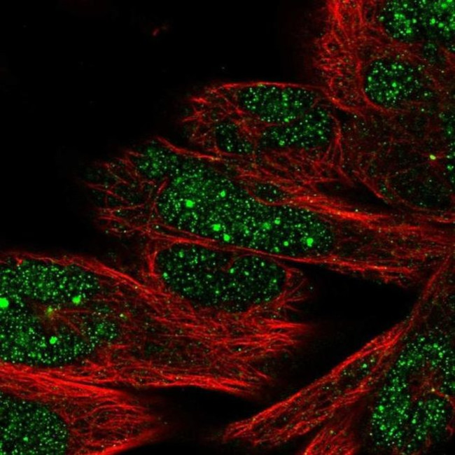 DHX35 Antibody in Immunocytochemistry (ICC/IF)