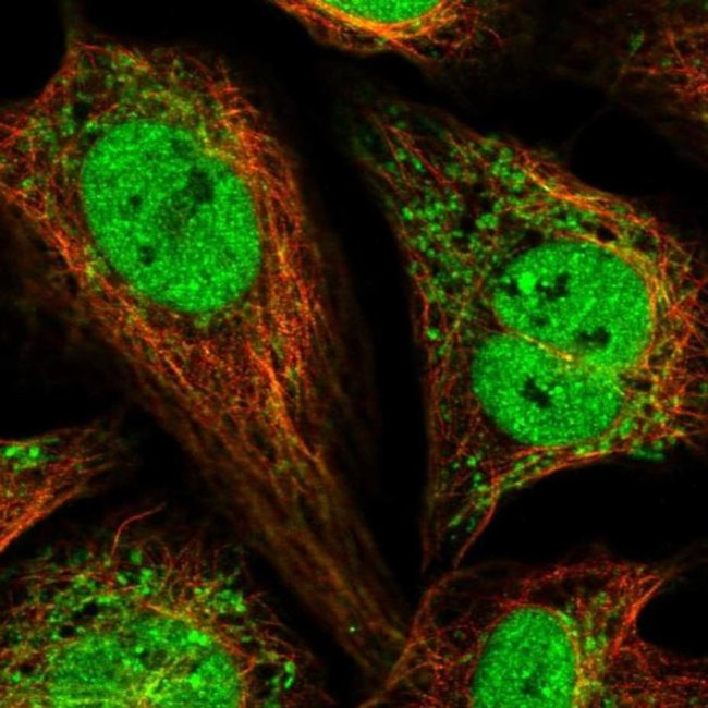 PAM16 Antibody in Immunocytochemistry (ICC/IF)