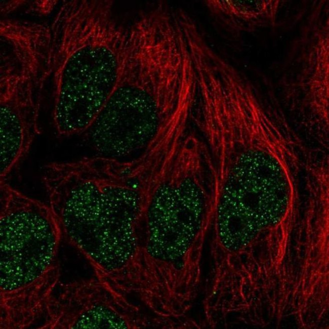 PITX2 Antibody in Immunocytochemistry (ICC/IF)