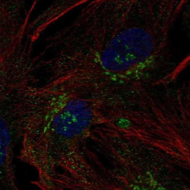 B3GNT9 Antibody in Immunocytochemistry (ICC/IF)