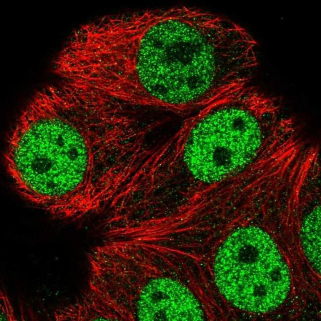 ATXN1L Antibody in Immunocytochemistry (ICC/IF)