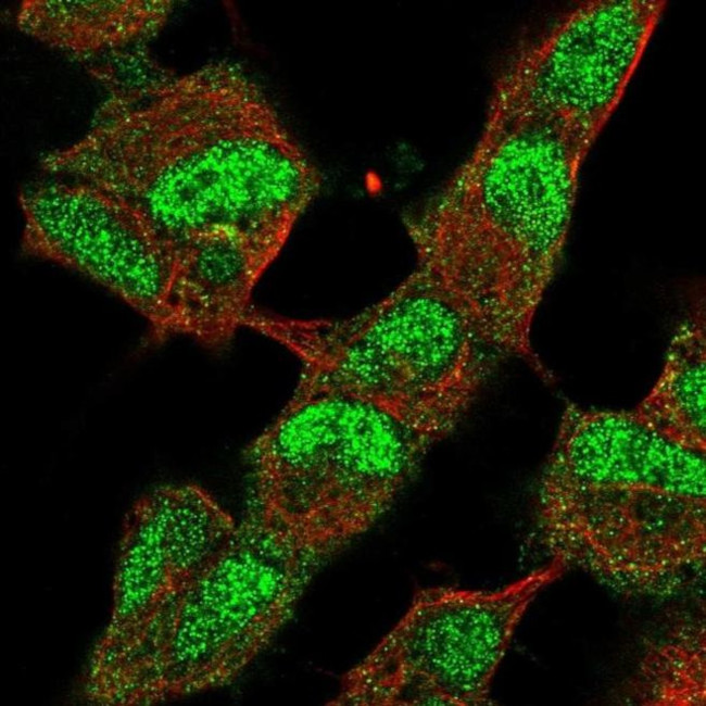 JMJD2B Antibody in Immunocytochemistry (ICC/IF)