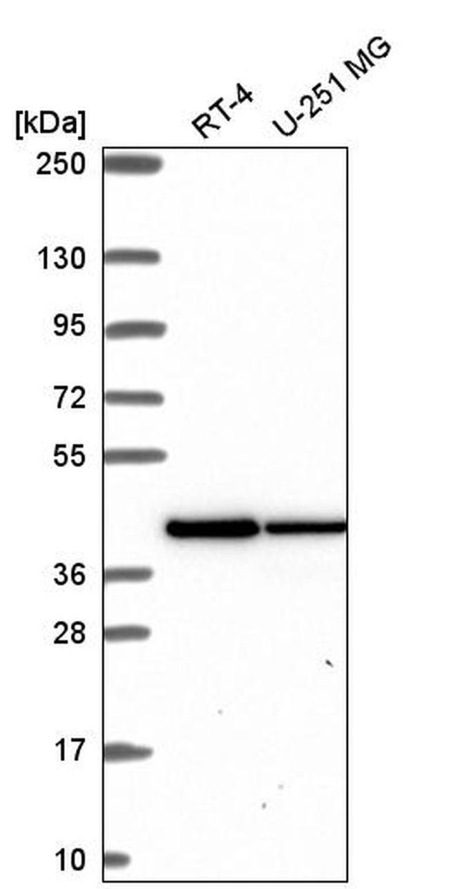 IDH3A Antibody in Western Blot (WB)