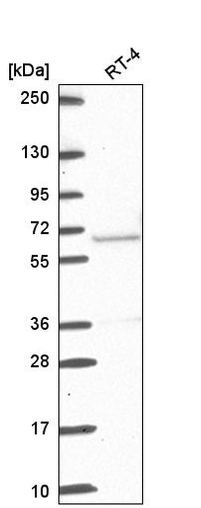 ETV5 Antibody in Western Blot (WB)