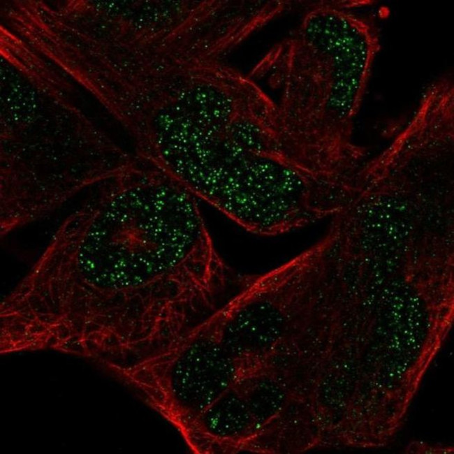 L-Myc Antibody in Immunocytochemistry (ICC/IF)