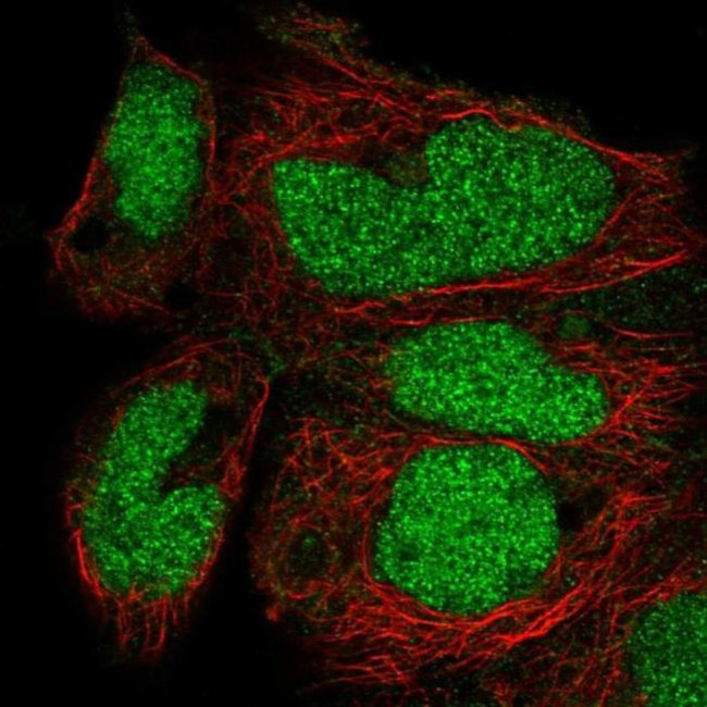 ZNF331 Antibody in Immunocytochemistry (ICC/IF)