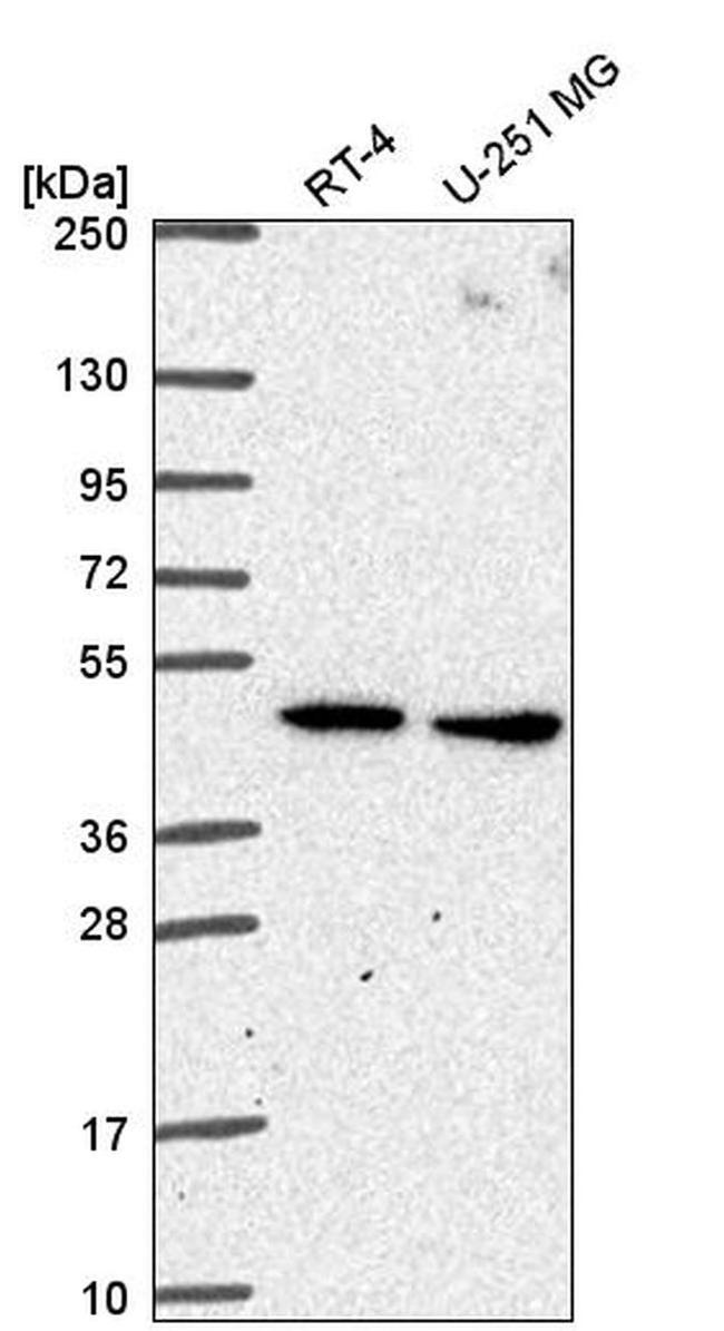 SLC25A24 Antibody in Western Blot (WB)