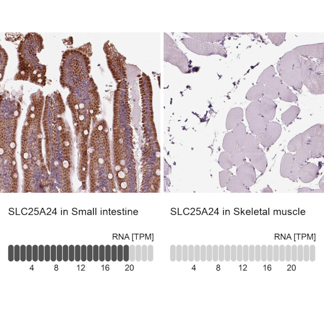 SLC25A24 Antibody