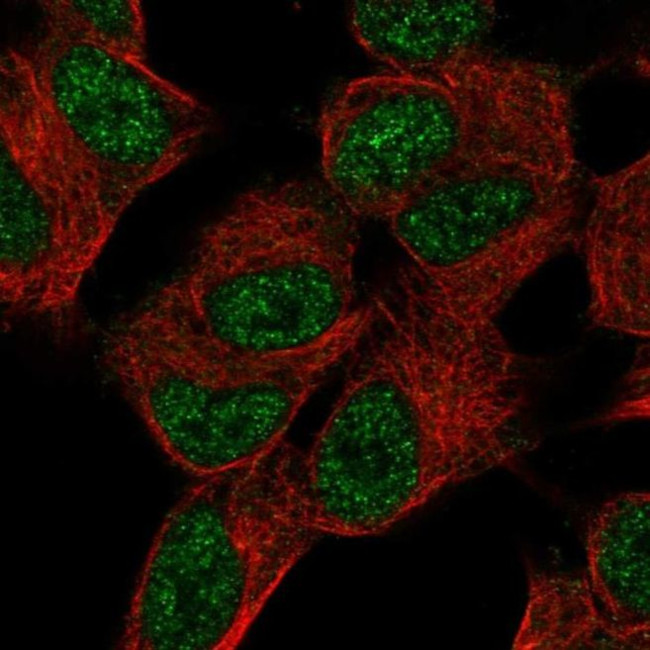 SUPT7L Antibody in Immunocytochemistry (ICC/IF)