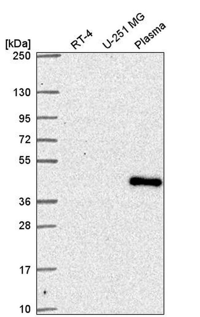 SUPT7L Antibody in Western Blot (WB)