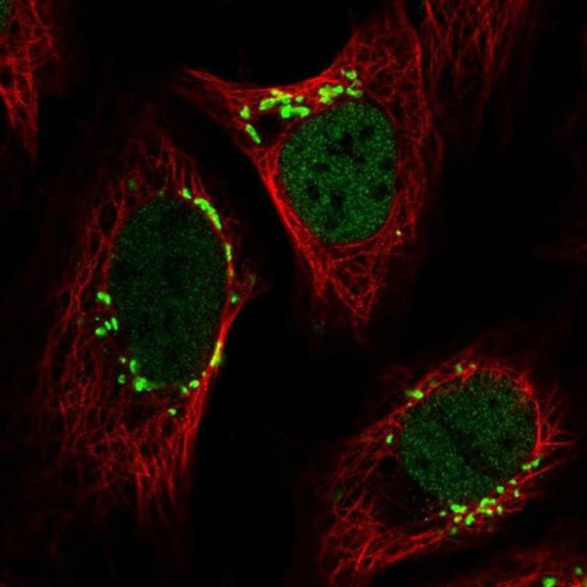 YIPF3 Antibody in Immunocytochemistry (ICC/IF)