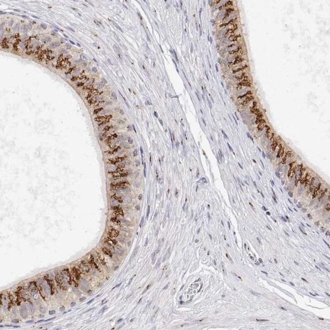 YIPF3 Antibody in Immunohistochemistry (IHC)