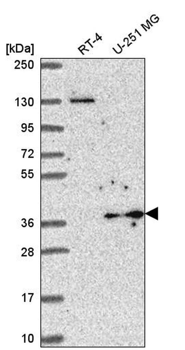 YIPF3 Antibody in Western Blot (WB)