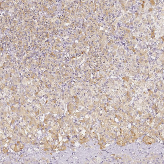 SLC18A1 Antibody in Immunohistochemistry (IHC)