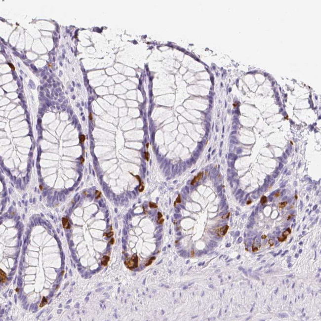 SLC18A1 Antibody in Immunohistochemistry (IHC)