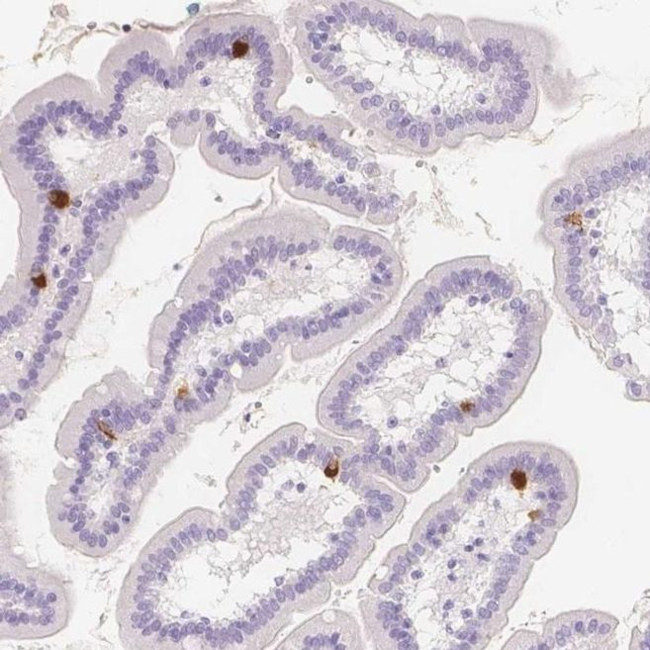 SLC18A1 Antibody in Immunohistochemistry (IHC)