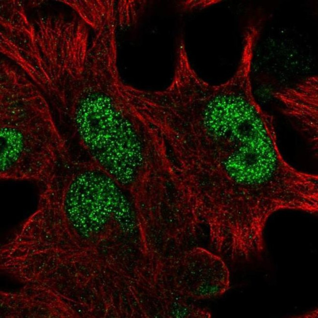 HOXD13 Antibody in Immunocytochemistry (ICC/IF)