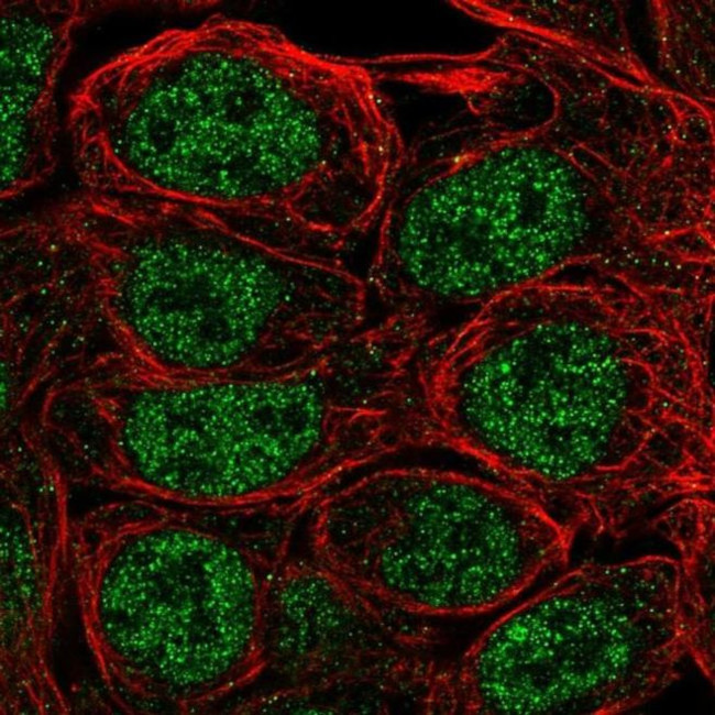 S100A5 Antibody in Immunocytochemistry (ICC/IF)