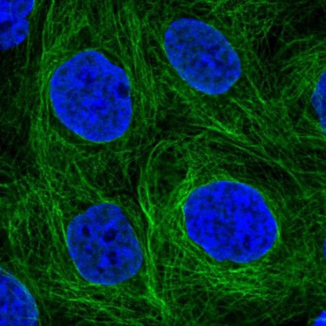 SH2D3A Antibody in Immunocytochemistry (ICC/IF)