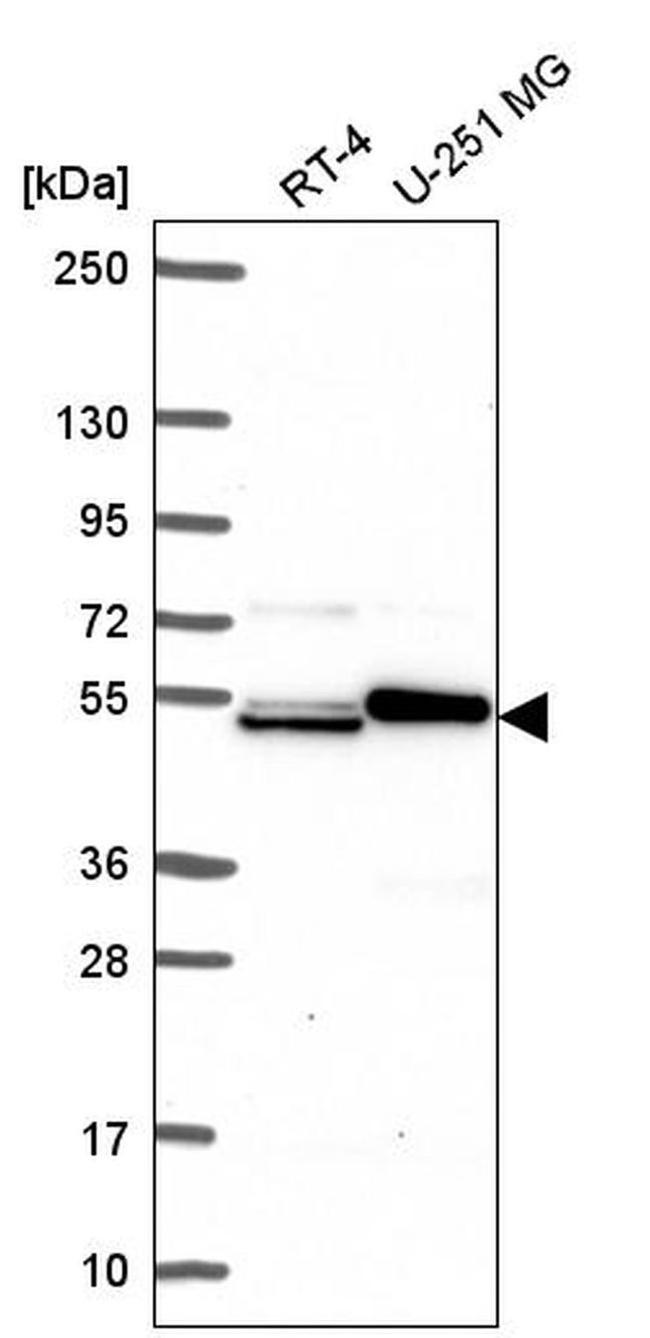 SH2D3A Antibody in Western Blot (WB)