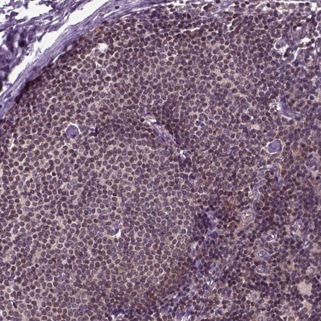 GOT1 Antibody in Immunohistochemistry (IHC)