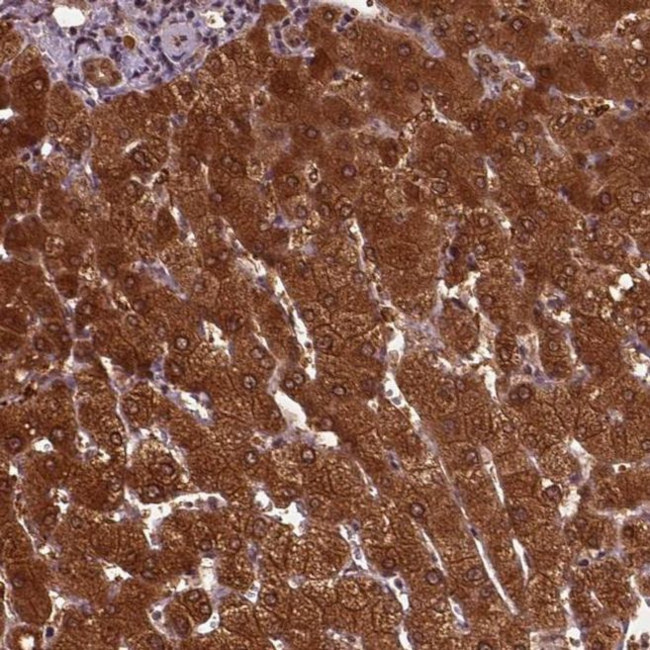 GOT1 Antibody in Immunohistochemistry (IHC)