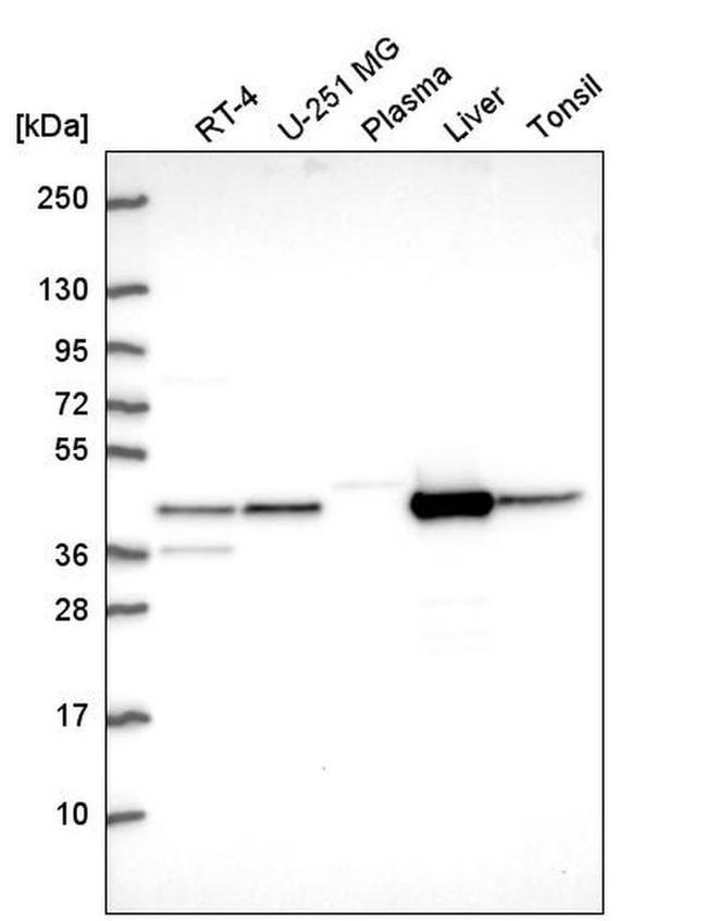 GOT1 Antibody in Western Blot (WB)