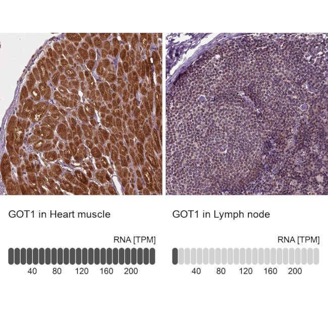 GOT1 Antibody