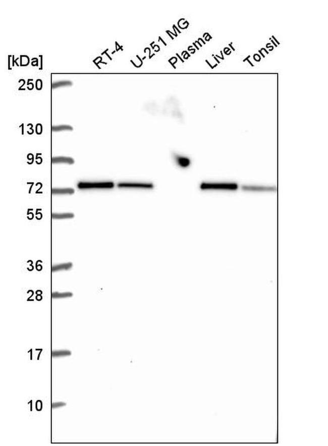 SDHA Antibody in Western Blot (WB)