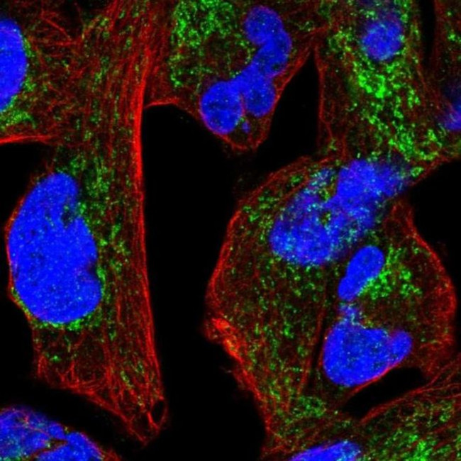 NDUFS1 Antibody in Immunocytochemistry (ICC/IF)