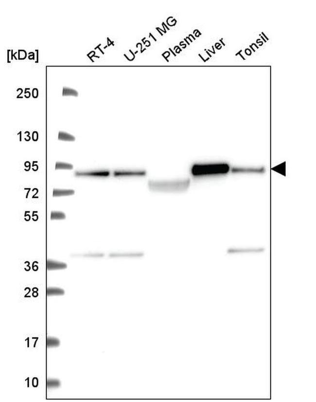 NDUFS1 Antibody in Western Blot (WB)