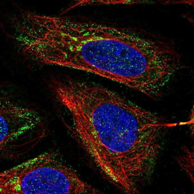 MICB Antibody in Immunocytochemistry (ICC/IF)