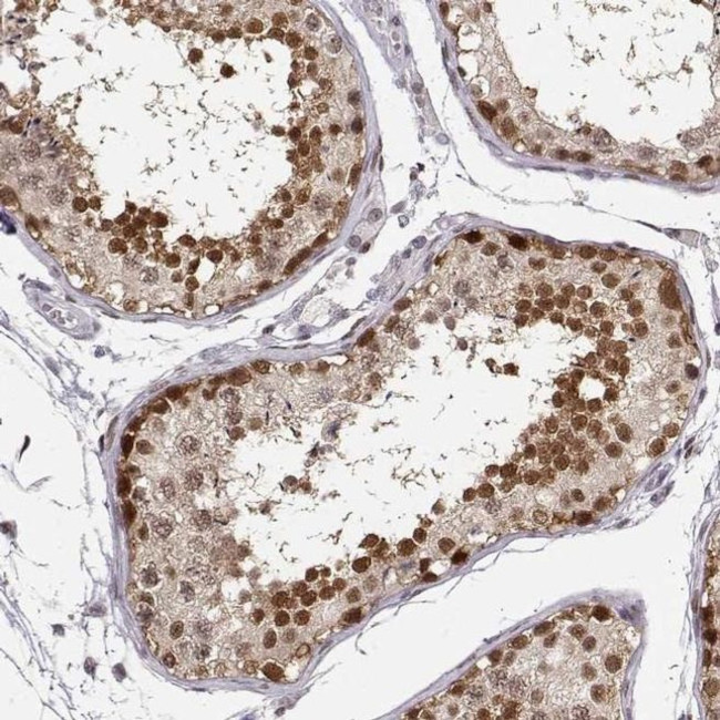 POLI Antibody in Immunohistochemistry (IHC)