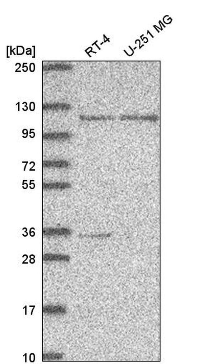 PHF16 Antibody in Western Blot (WB)