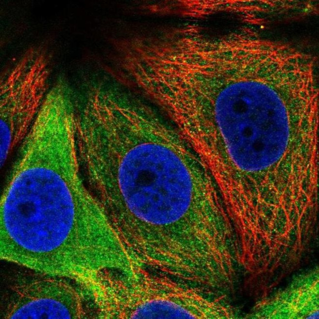 Asparagine Synthetase Antibody in Immunocytochemistry (ICC/IF)