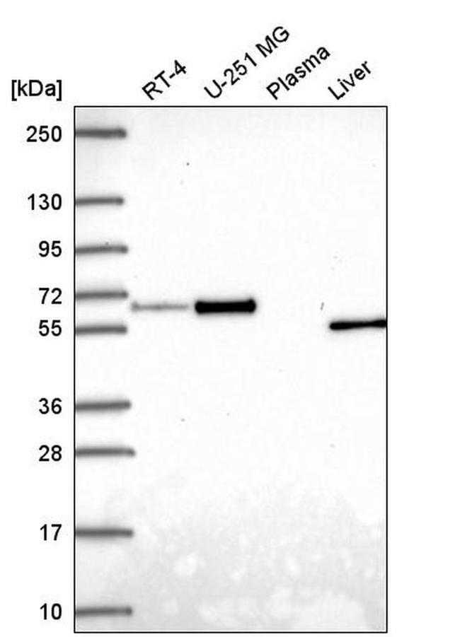 Asparagine Synthetase Antibody in Western Blot (WB)
