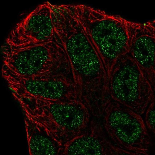 ABCA6 Antibody in Immunocytochemistry (ICC/IF)