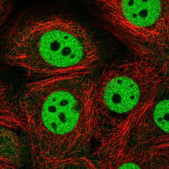 CSTF1 Antibody in Immunocytochemistry (ICC/IF)