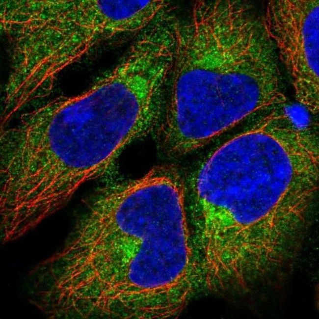 beta-1 Adaptin Antibody in Immunocytochemistry (ICC/IF)