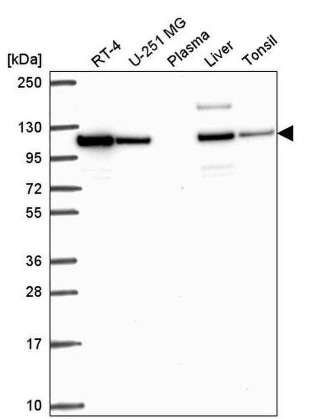 beta-1 Adaptin Antibody in Western Blot (WB)