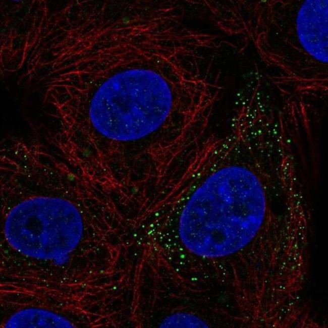 Kindlin 3 Antibody in Immunocytochemistry (ICC/IF)