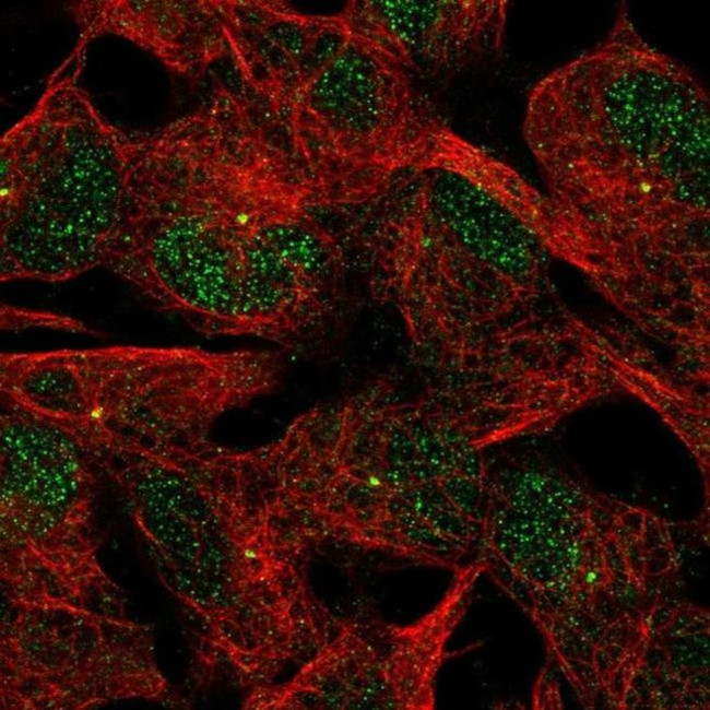 ACTR8 Antibody in Immunocytochemistry (ICC/IF)