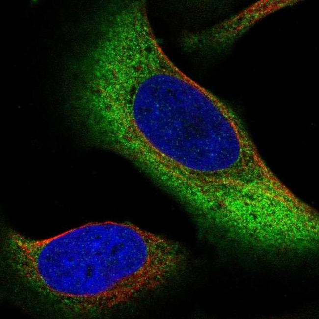 ZNF721 Antibody in Immunocytochemistry (ICC/IF)