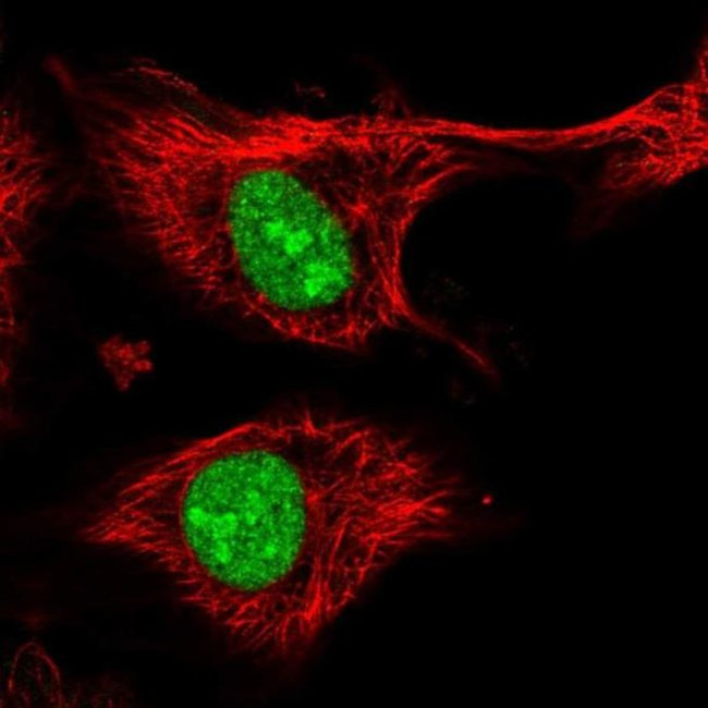 ZFP91 Antibody in Immunocytochemistry (ICC/IF)