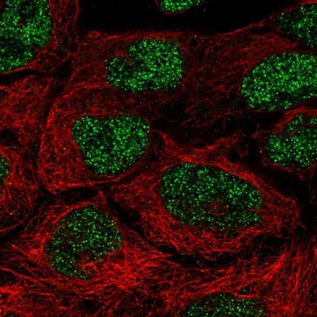 NAALAD2 Antibody in Immunocytochemistry (ICC/IF)