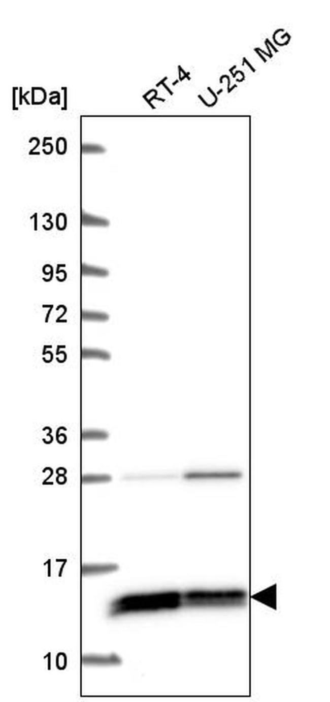 WDR83OS Antibody in Western Blot (WB)