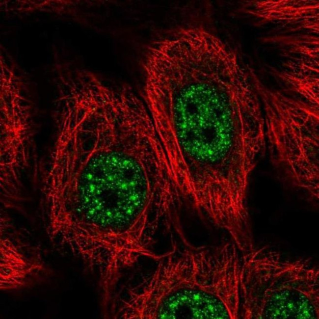 VPS72 Antibody in Immunocytochemistry (ICC/IF)