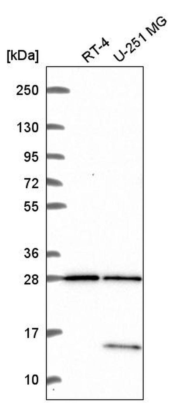 TBC1D16 Antibody in Western Blot (WB)