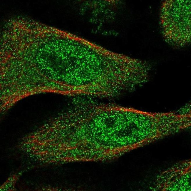 TXNL4B Antibody in Immunocytochemistry (ICC/IF)