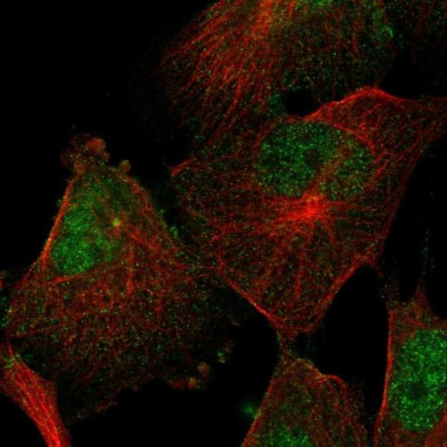 SEMA4F Antibody in Immunocytochemistry (ICC/IF)